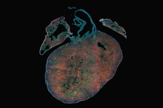 Postnatal heart atlas