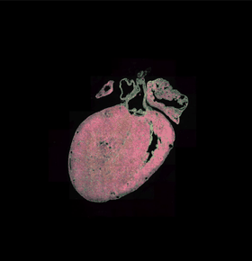 Animated postnatal heart atlas
